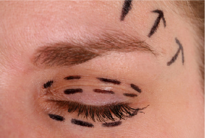 plasticsurgery